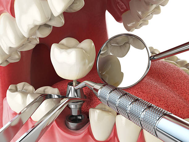 Best Emergency Wisdom Teeth Removal in Hamilton, GA